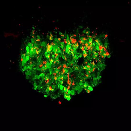 ▲当肠道感受到盐水后，大脑中控制“渴感”的神经元会被激活（图片来源：Knight Lab/UCSF/HHMI）